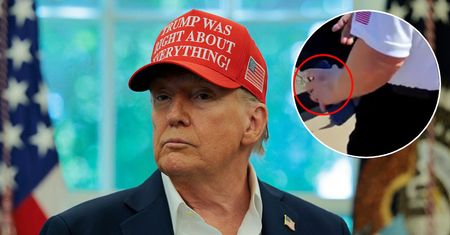 Nowy siniak na dłoni Donalda Trumpa. Rzeczniczka Białego Domu tłumaczy