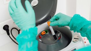 Bezpłatne badania laboratoryjne dla mieszkańców Małej Nieszawki. Ruszył program profilaktyczny