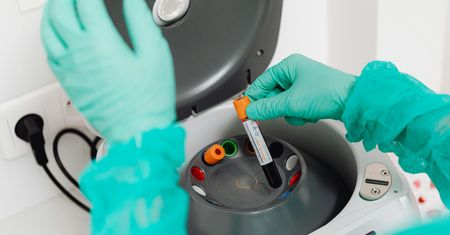 Bezpłatne badania laboratoryjne dla mieszkańców Małej Nieszawki. Ruszył program profilaktyczny