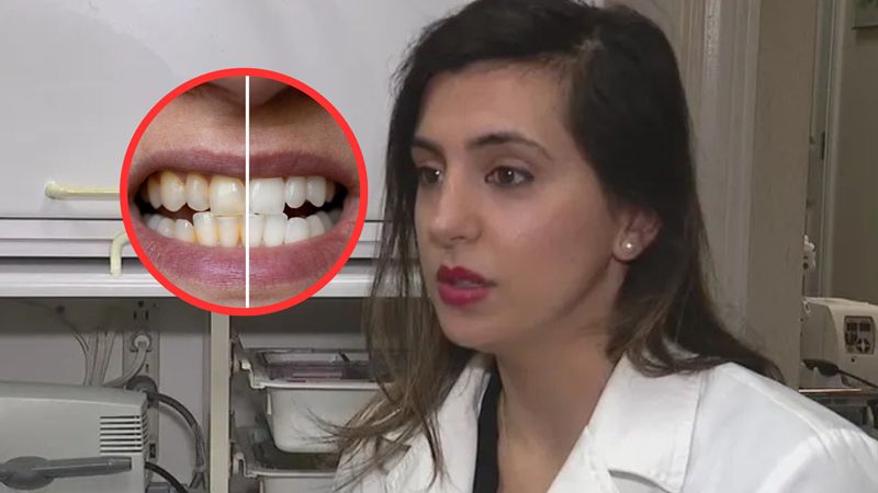 Dlaczego zęby żółkną mimo regularnego szczotkowania?