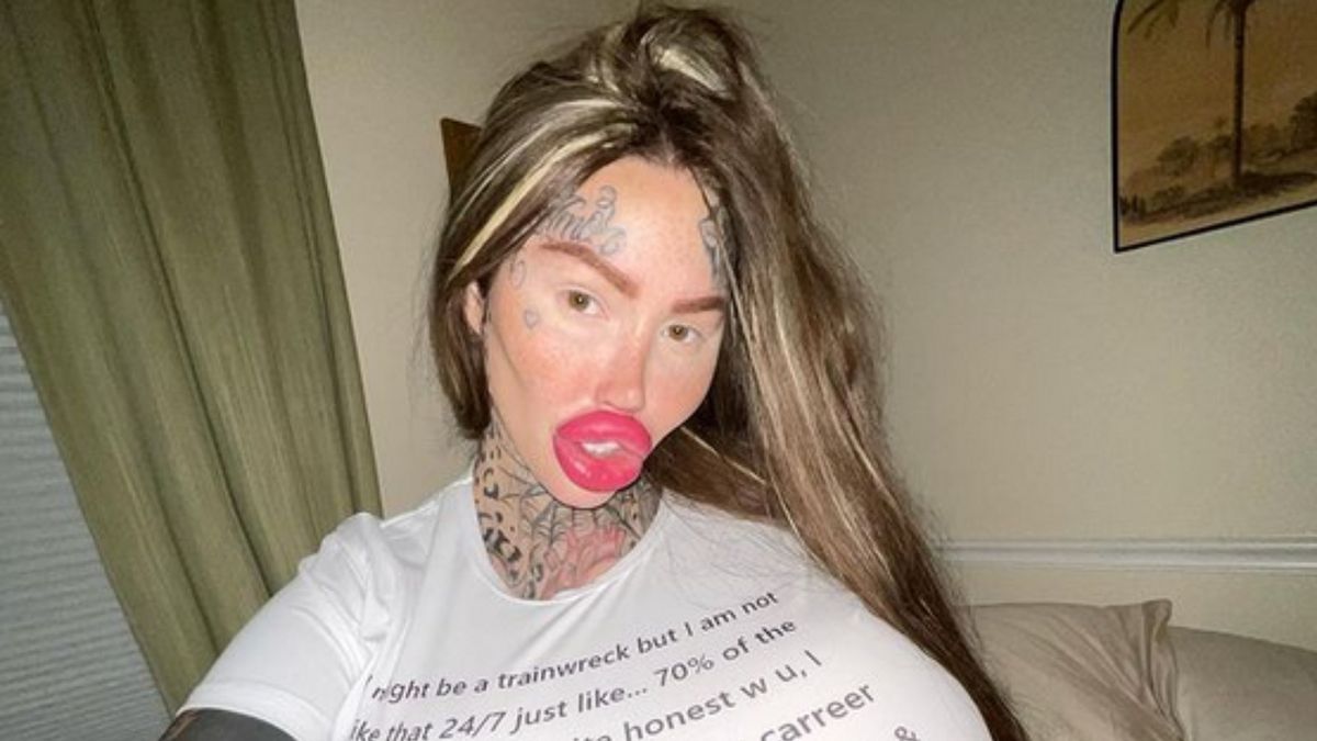 30-latce pękł pięciokilogramowy implant