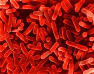 Spryskiwacze i wycieraczki z bakteriami Legionella
