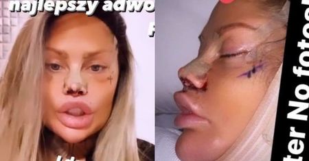 Laluna Unique z "Królowych Życia" i jej nowa twarz pozdrawiają hejterów: "Mam wy***ane. Wyglądam PRZEKOZACKO"
