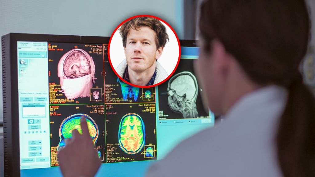 Mózg dojrzewa znacznie dłużej, niż zwykliśmy myśleć