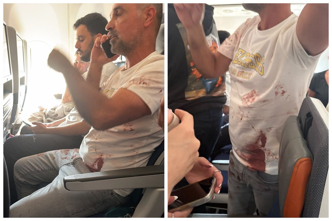 Bójka pilotów na pokładzie. Jest krew. Do sieci trafiły zdjęcia