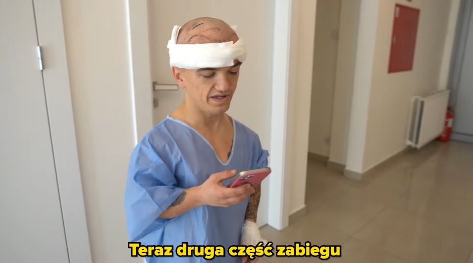 Mini Majk przeszczepił sobie włosy