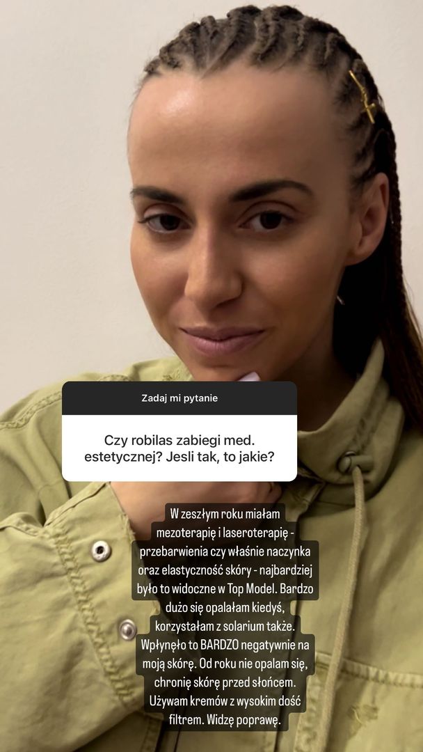 Marianna Schreiber szczerze o medycynie estetycznej