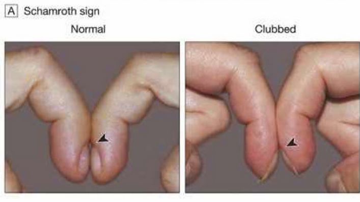 Zmiany będą widoczne gołym okiem