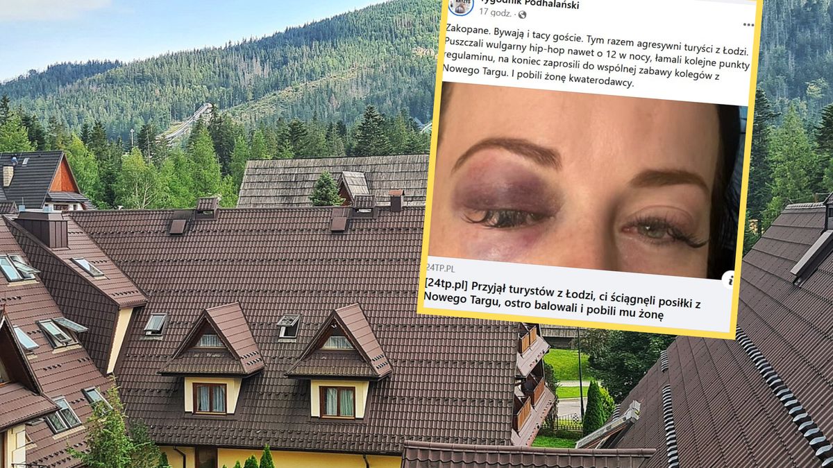 Turyści mieli zaatakować pana Artura i jego żonę. Policja wyjaśnia sprawę 