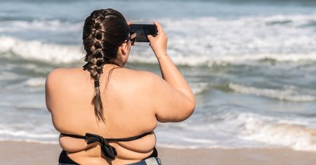 "Moje rozstępy to moja historia". Na plaży przestała się wstydzić