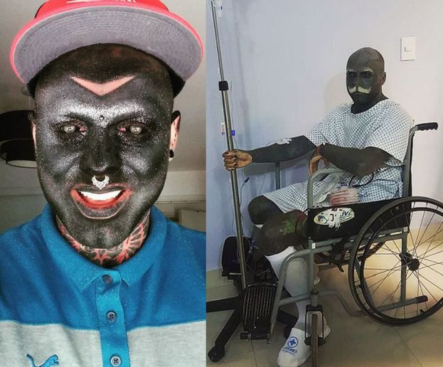 Wytatuowany 32-latek z Poznania o usunięciu narządów płciowych: "BYŁY MI ZBĘDNE! To jak mieć wrzód na ciele"