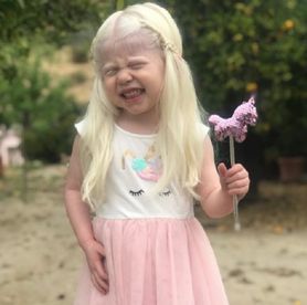 Tatiana Garcia jest albinoską. Dziewczynka podbija Instagram