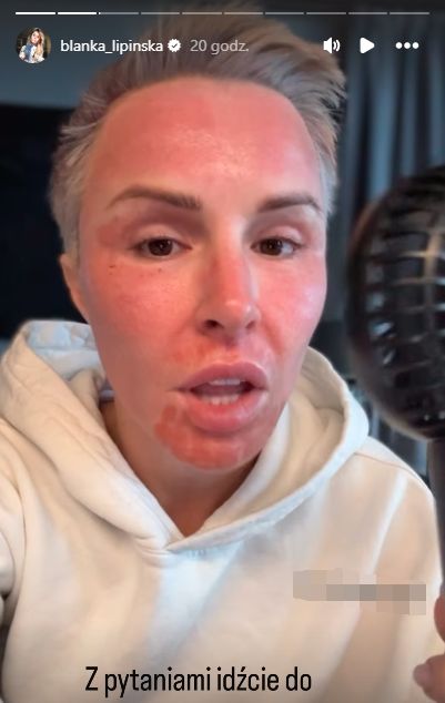 Blanka Lipińska poddała się kolejnemu zabiegowi