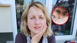 Laura od 27 lat wyrywa sobie włosy z głowy. "W akcie rozpaczy ogoliłam się na łyso"