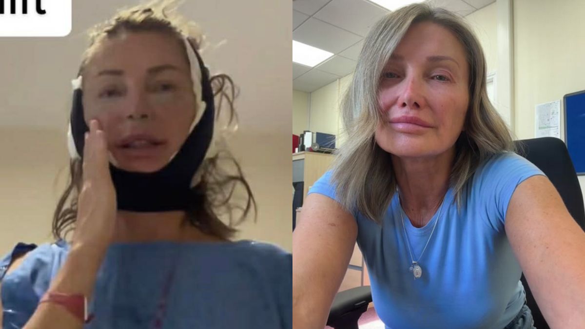 Zafundowała sobie lifting w Turcji. Wygląda na o 20 lat młodszą