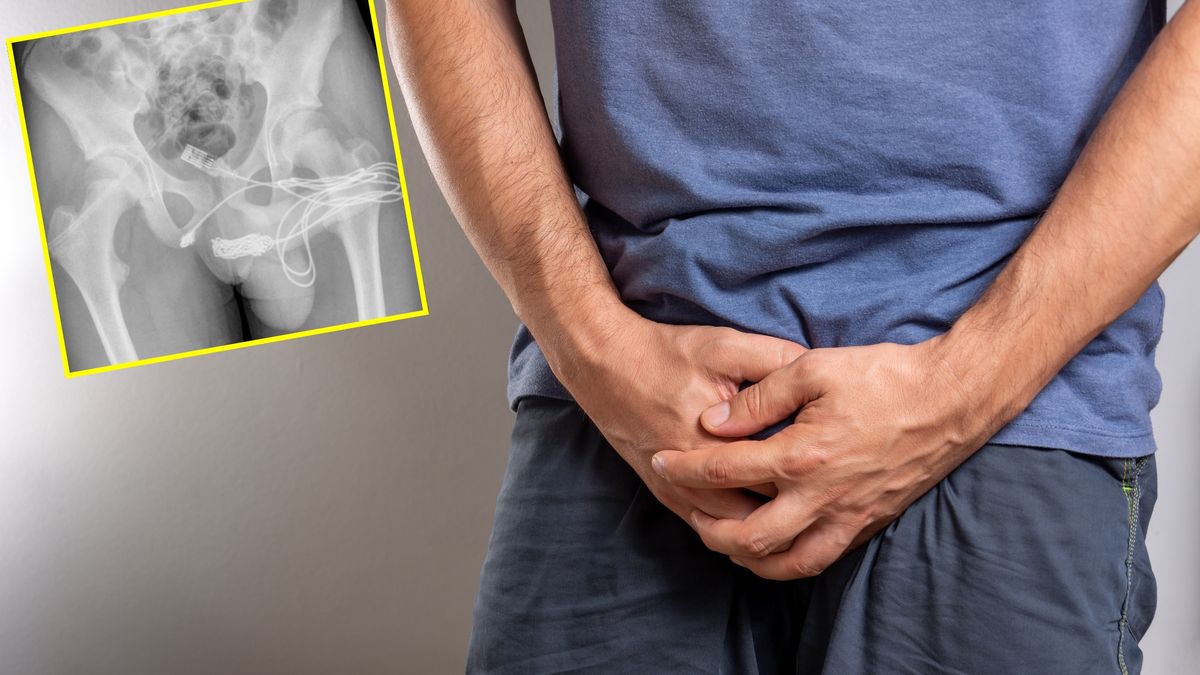 15-latek włożył sobie do członka kabel USB 