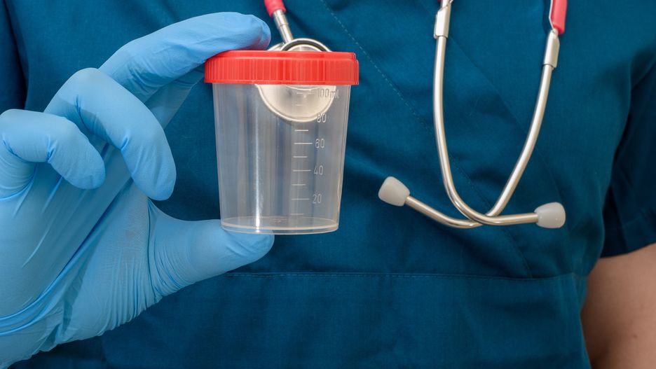 Zespół nerczycowy to choroba związana ze zbyt dużą utratą przez nerki białka, które jest wydalane wraz z moczem.