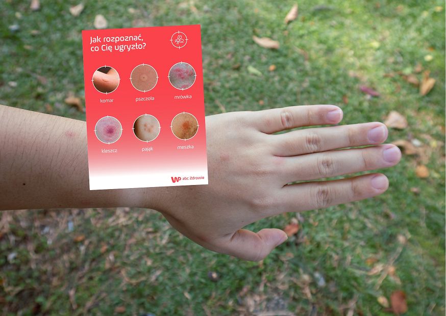 Najgorsze ukąszenie. W połączeniu z alkoholem może aktywować groźną chorobę