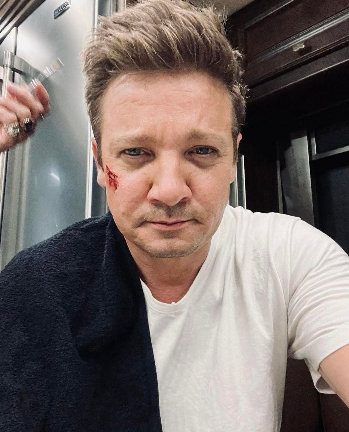 Jeremy Renner pokazał zdjęcie z rehabilitacji