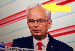 Wpadka podczas debaty prezydenckiej. Na głowie kandydata usiadła...mucha