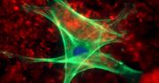 Ipilimumab - bat na czerniaka?