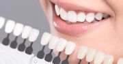 Wybielanie zębów w domu – jakie metody są najskuteczniejsze?