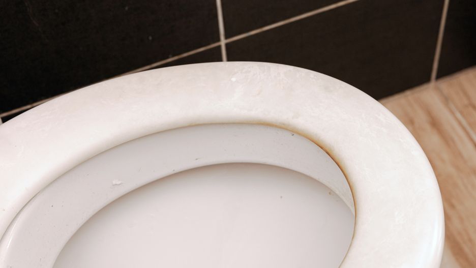 Czyszczenie deski sedesowej nie jest najprzyjemniejszą czynnością