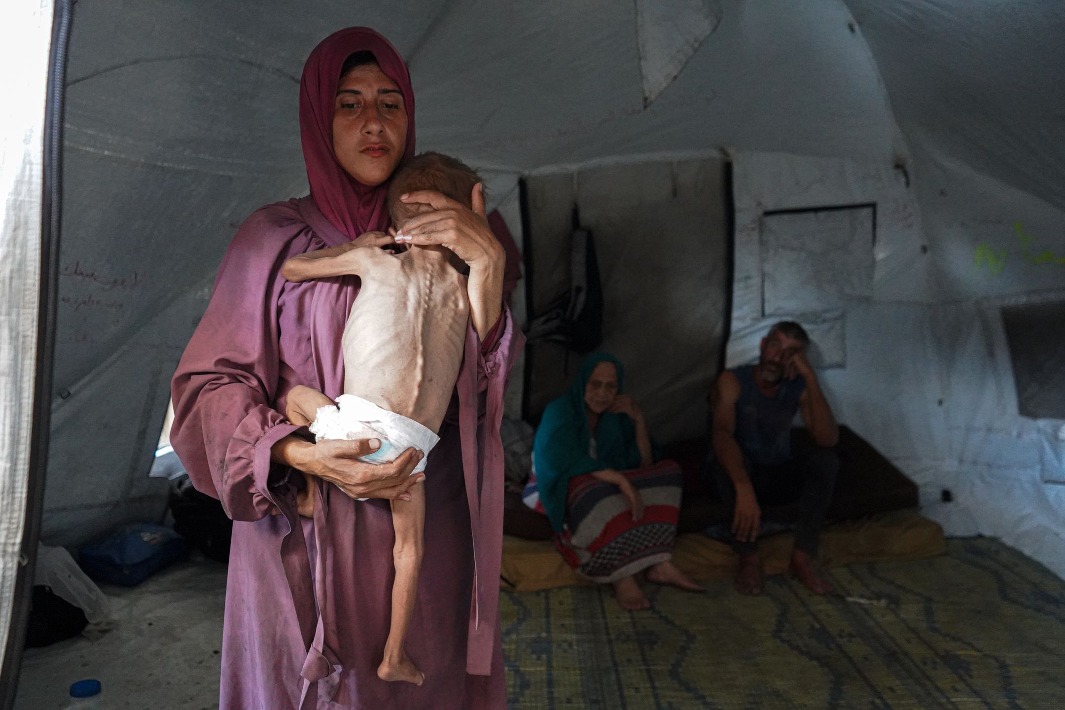 Niedożywione palestyńskie dziecko