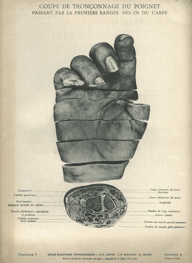 Niesamowite, piękne i odrażające. Eksponaty z National Library of Medicine [TOP 12]