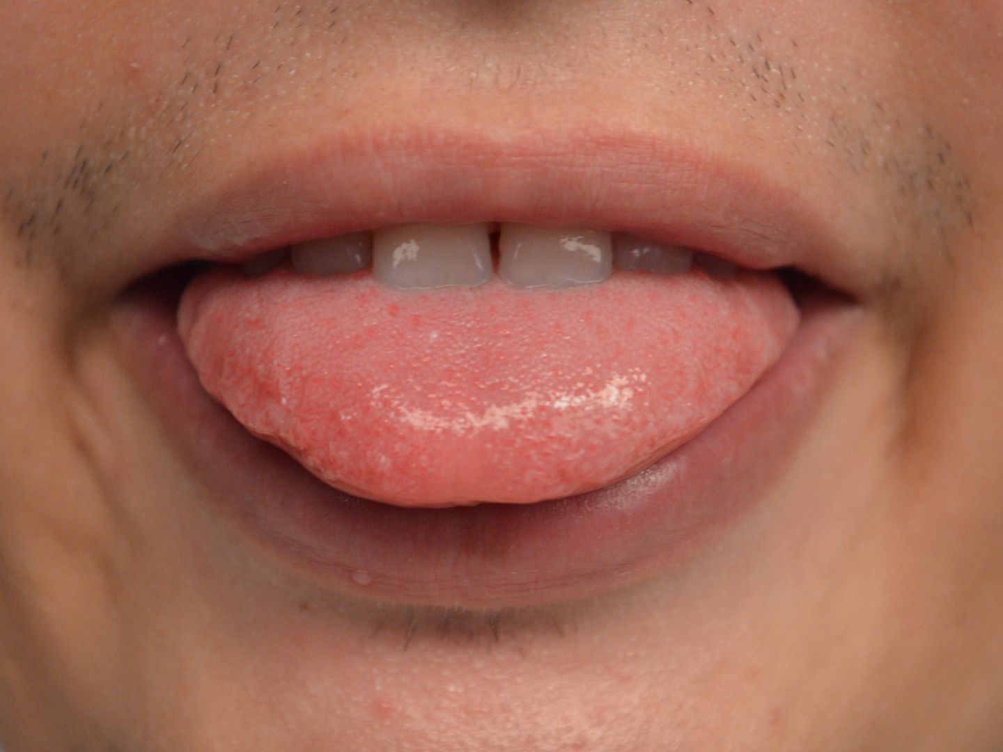 To objaw raka. Odkrył go dentysta