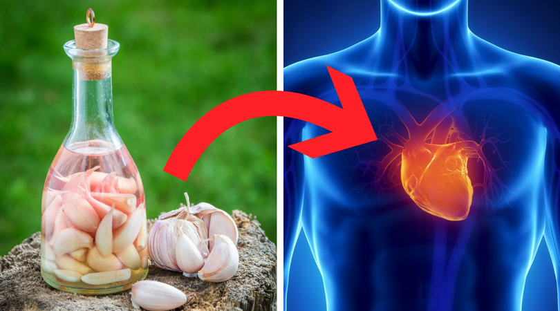 Nalewka czosnkowa, która chroni przed zawałem