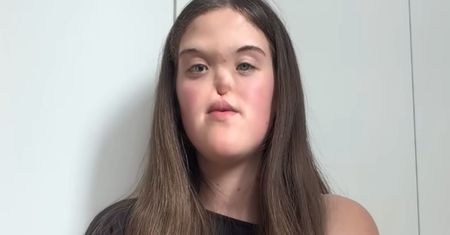 "Szok dla lekarzy". 18 lat później Polka zabrała głos