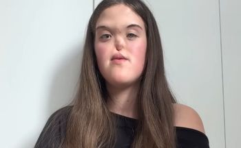 "Szok dla lekarzy". 18 lat później Polka zabrała głos