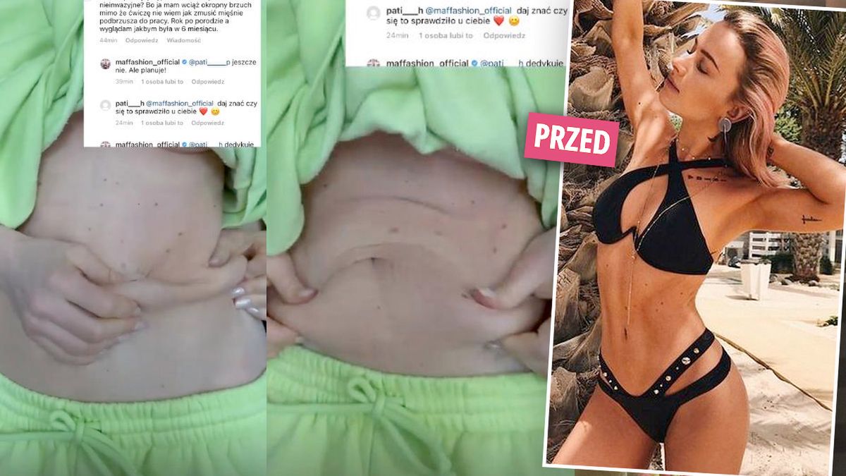 Brzuch Maffashion po ciąży