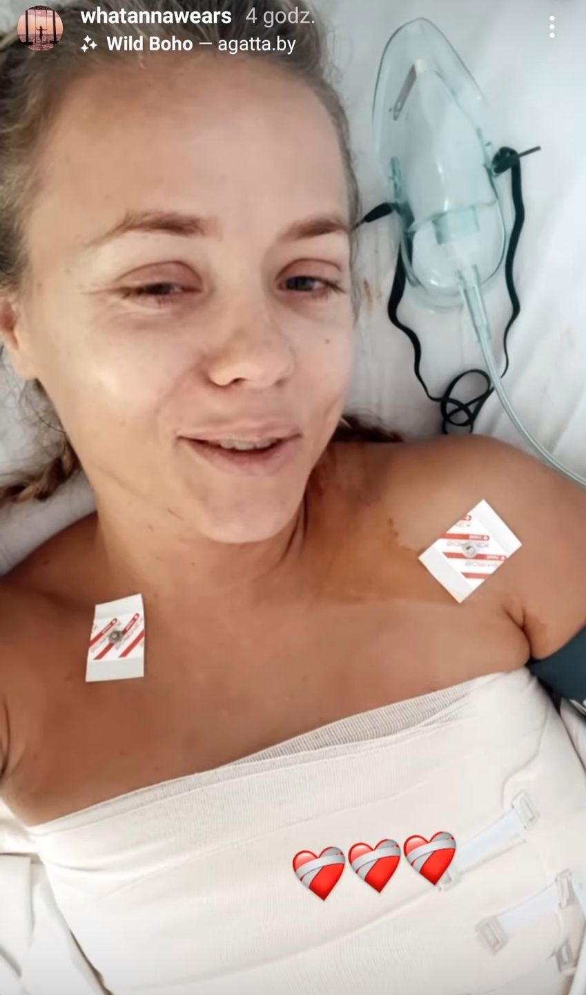 Anna Skura przeszła poważną operację