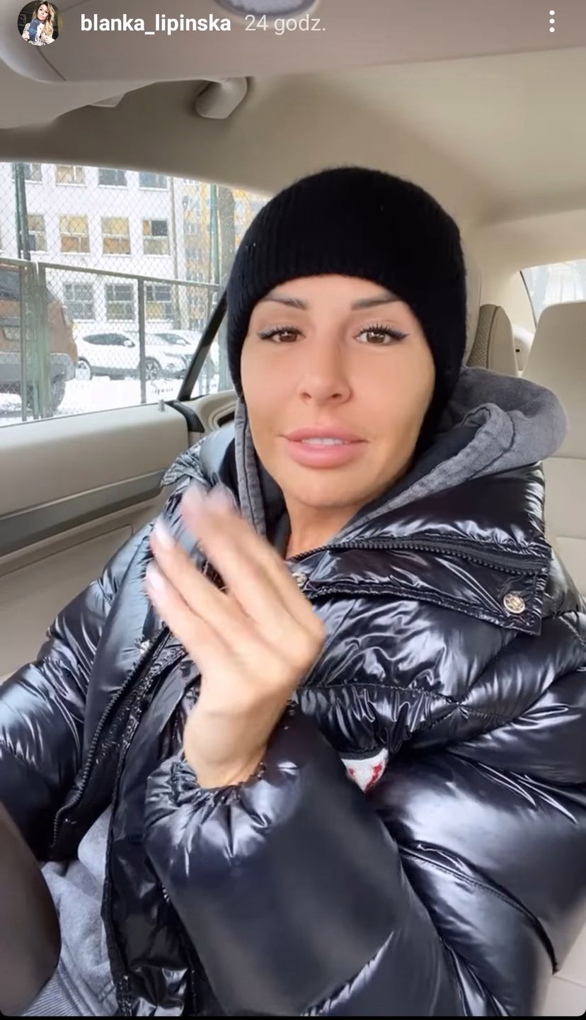 Blanka Lipińska poprawiła zęby