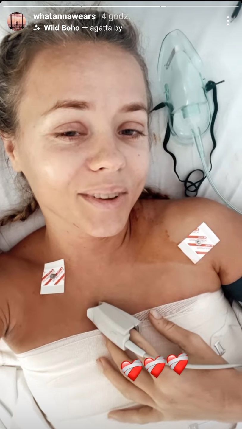 Anna Skura przeszła poważną operację