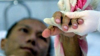 Chory na AIDS w chińskim szpitalu