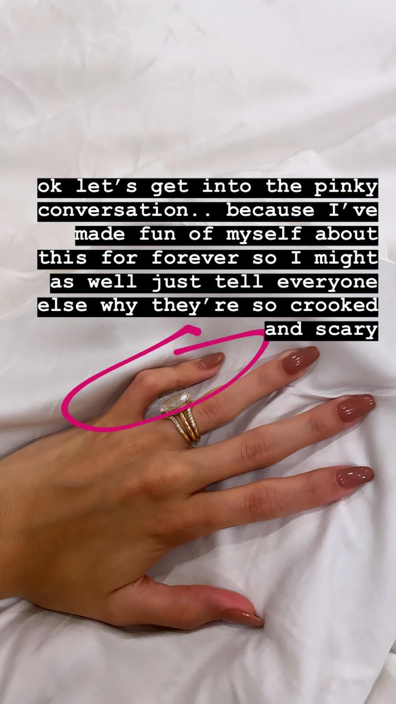 Hailey Bieber ma wadę dłoni