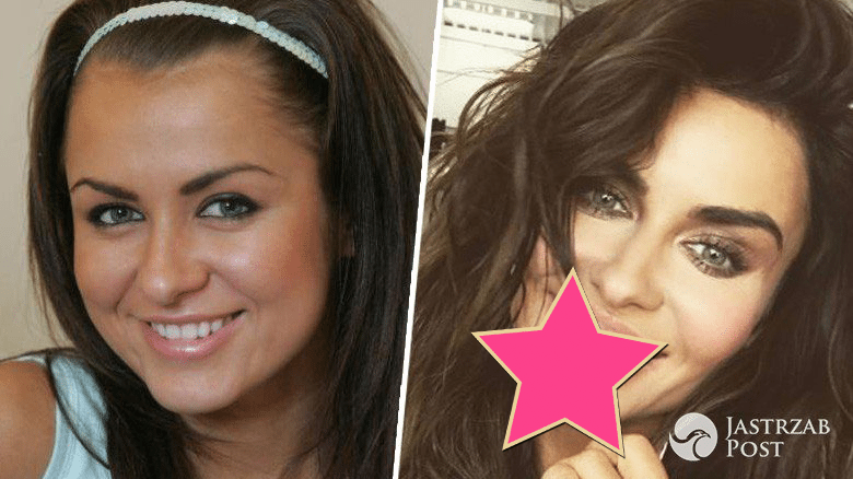 Natalia Siwiec - nowe zęby