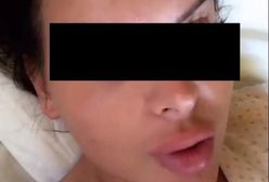 "Esmeralda" G. zdeformowanymi ustami mówi, że żałuje tego, co się stało