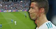To były sceny rodem z najstraszniejszego horroru! Podczas ostatniego meczu zalany krwią Ronaldo musiał zejść z boiska! [WIDEO]