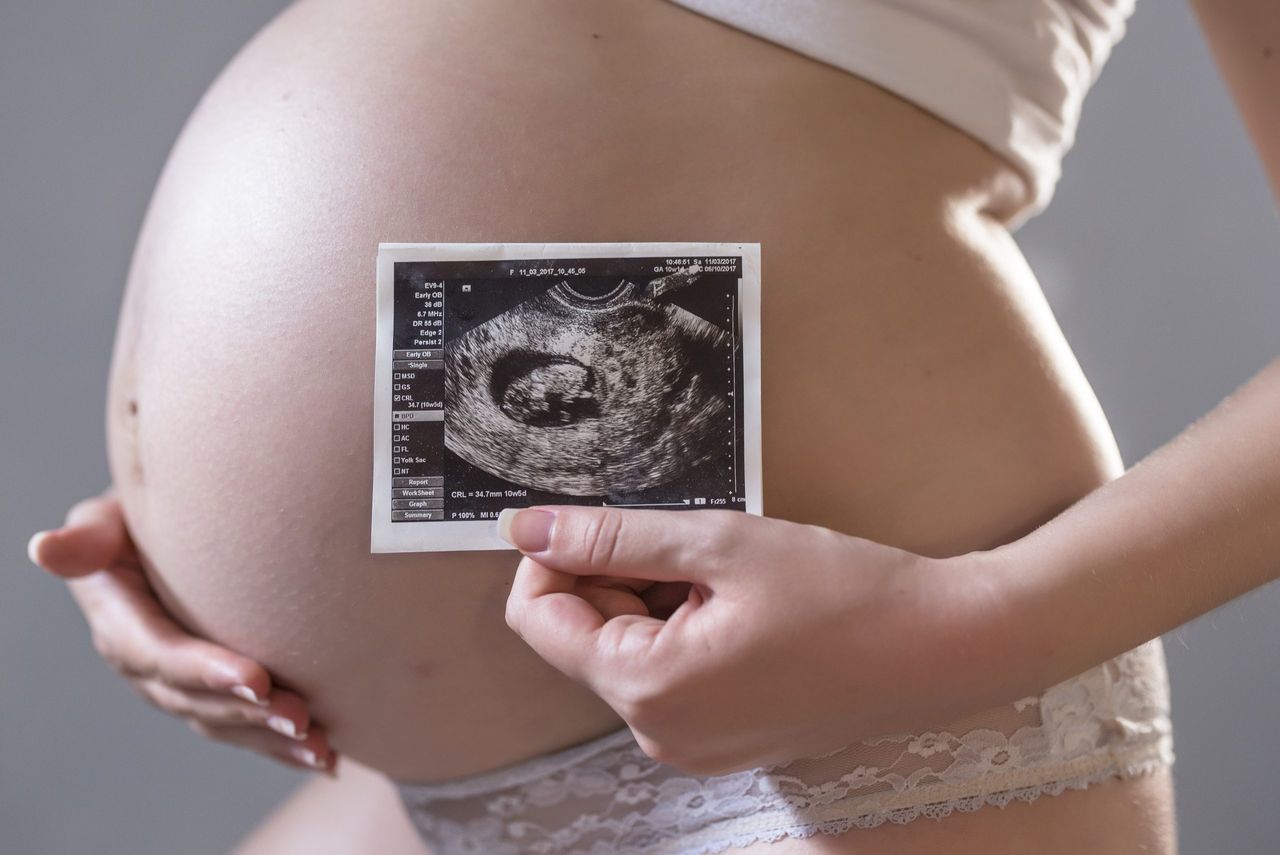 Close-up of belly of young pregnant model showing ultrasonic image of her baby. Future mom on her second trimester holding ultrasound scan of her child. Maternity concept