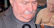 Lech Wałęsa pokazał dużą ranę po operacji serca. Boli od samego patrzenia