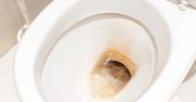 Jak usunąć rdzawe zacieki z toalety? Jeden naturalny składnik zmyje je bez szorowania
