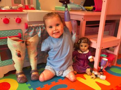 2-latka, której amputowano wszystkie kończyny, otrzymała lalkę wyglądającą tak samo jak ona
