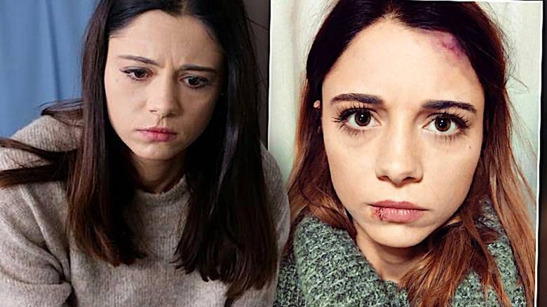 Adriana Kalska pobita w M jak miłość