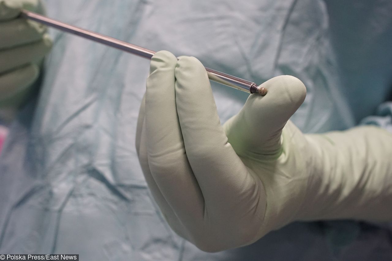 Rodzina położnej wywalczyła prawie 300 tys. zł odszkodowania. Kobiecie źle podano znieczulenie