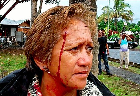 Chile: policja zbombardowana kamieniami
