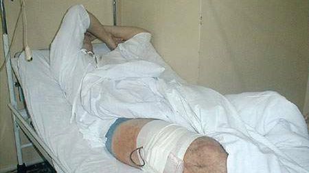 Łukasz mógł wykrwawić się na śmierć